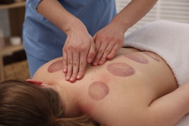Photo of Cupping therapy. Woman receiving professional massage in spa salon, closeup