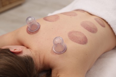 Photo of Cupping therapy. Woman with plastic cups on her back in spa salon, closeup