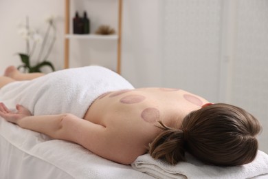 Photo of Woman after cupping therapy in spa salon