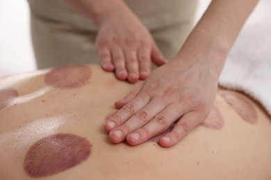 Photo of Cupping therapy. Woman receiving professional massage in spa salon, closeup
