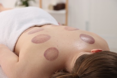 Photo of Woman after cupping therapy in spa salon, closeup