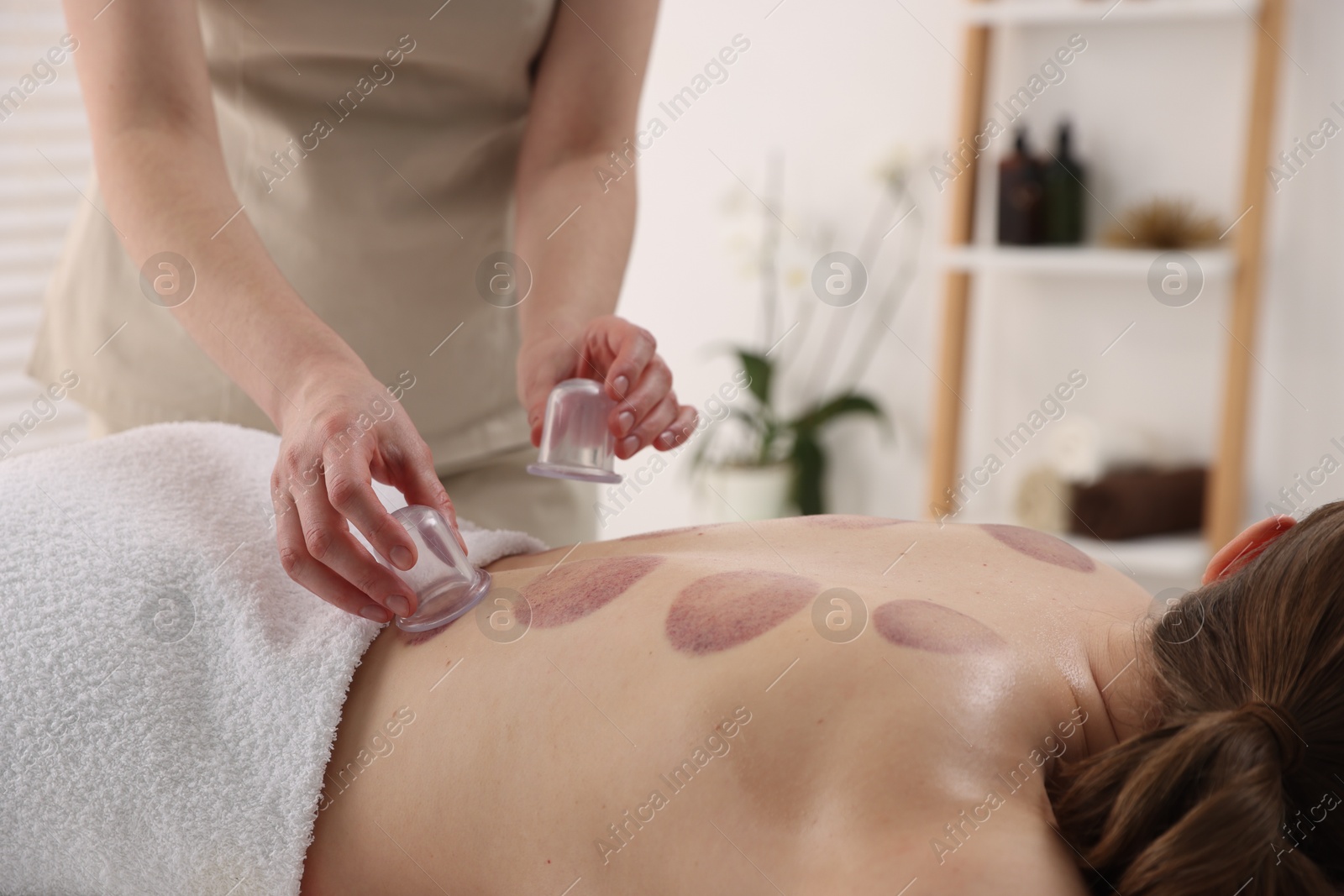 Therapist giving cupping treatment to patient in spa salon, closeup Photo of Therapist giving cupping treatment to patient in spa salon, closeup