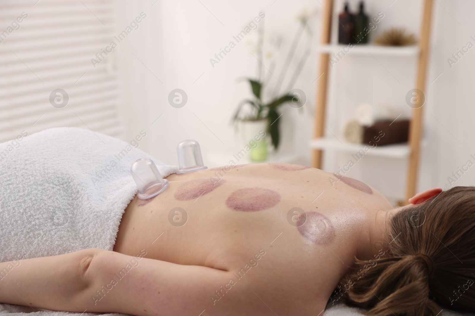 Photo of Cupping therapy. Woman with cups in spa salon