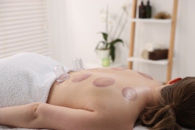 Photo of Cupping therapy. Woman with cups in spa salon