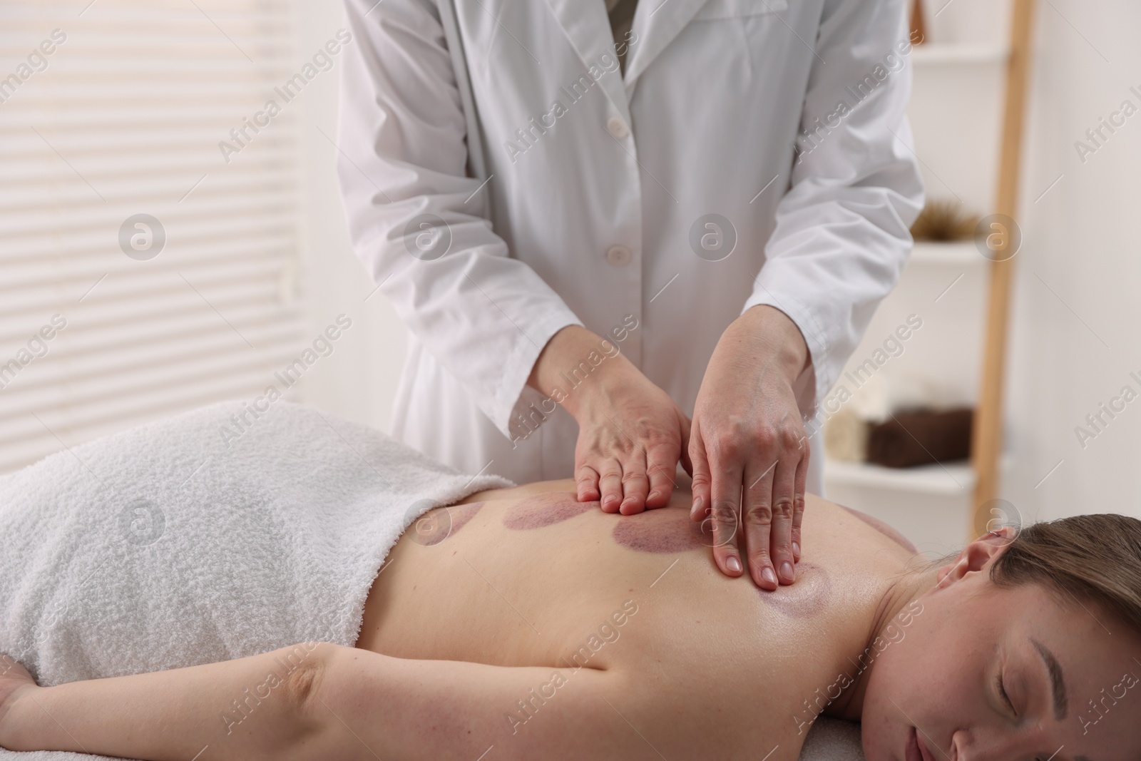 Cupping therapy. Woman receiving professional massage in spa salon, closeup Photo of Cupping therapy. Woman receiving professional massage in spa salon, closeup