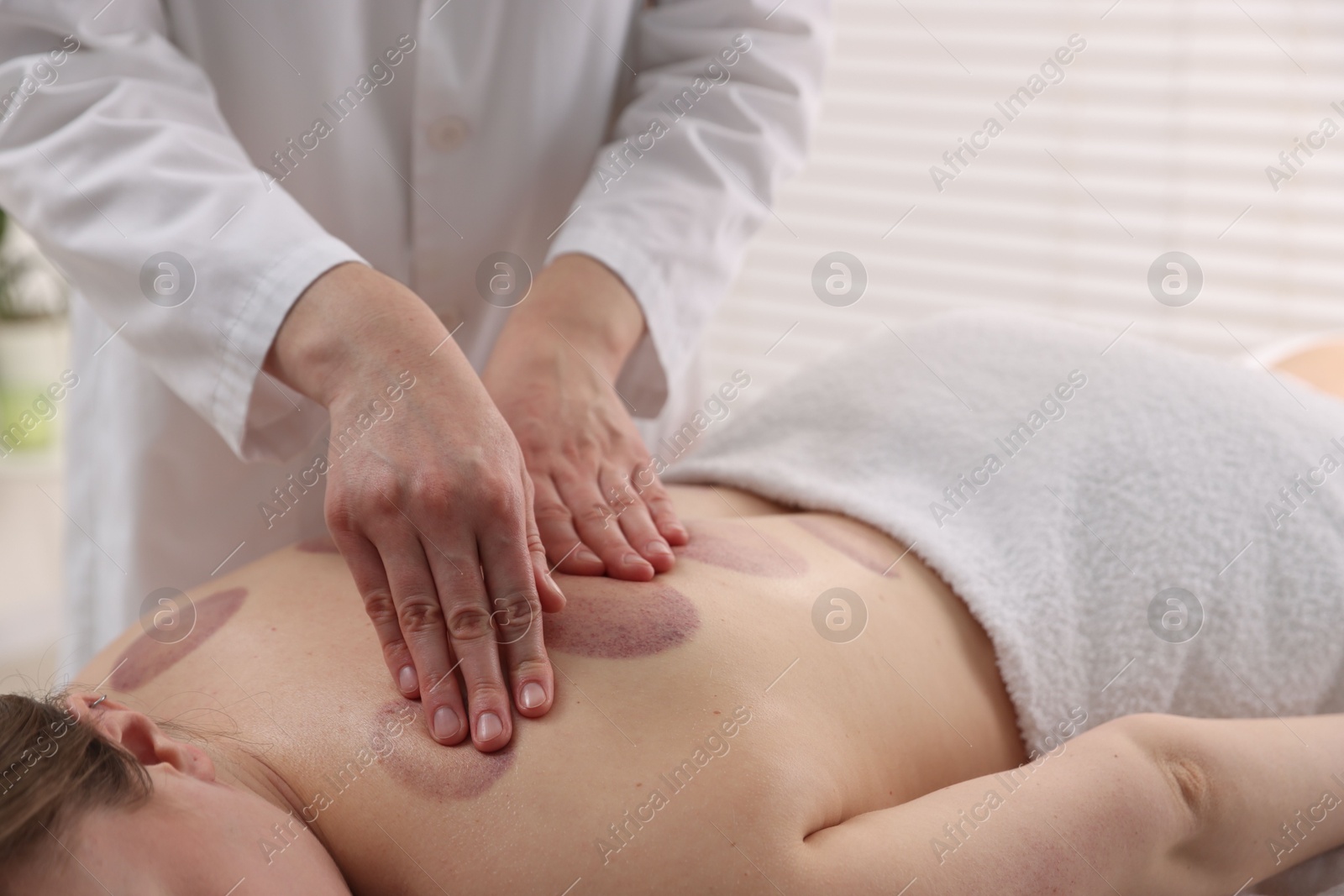 Cupping therapy. Woman receiving professional massage in spa salon, closeup Photo of Cupping therapy. Woman receiving professional massage in spa salon, closeup