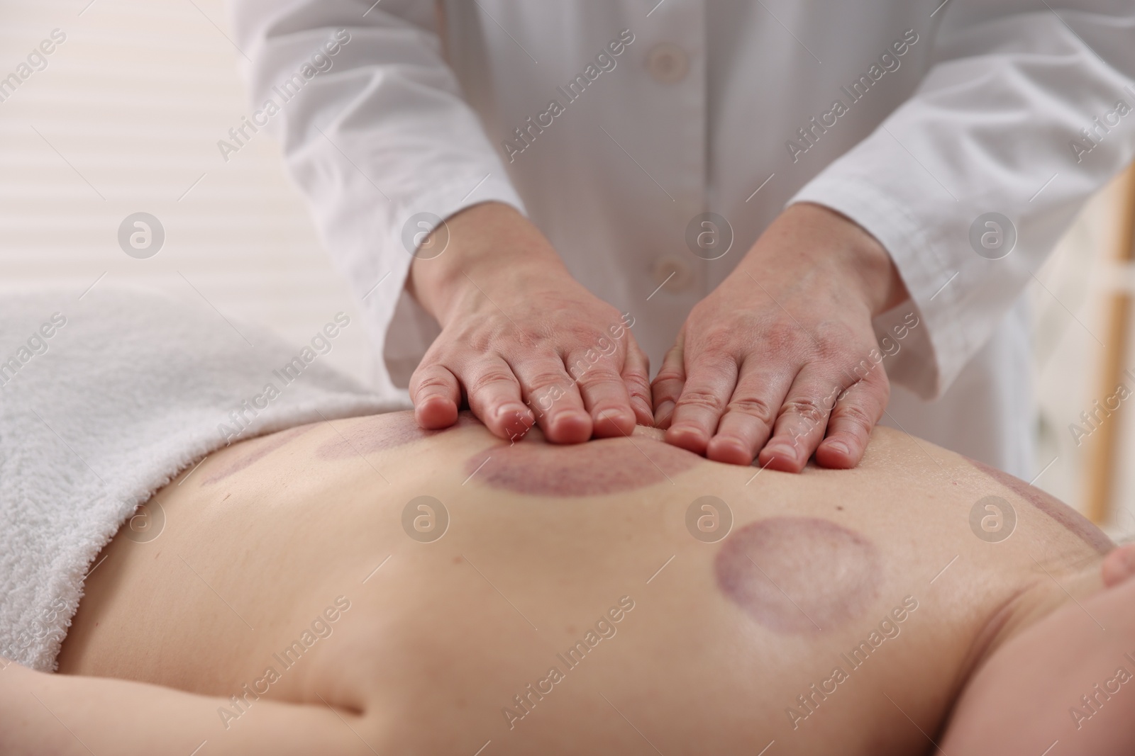 Cupping therapy. Woman receiving professional massage in spa salon, closeup Photo of Cupping therapy. Woman receiving professional massage in spa salon, closeup