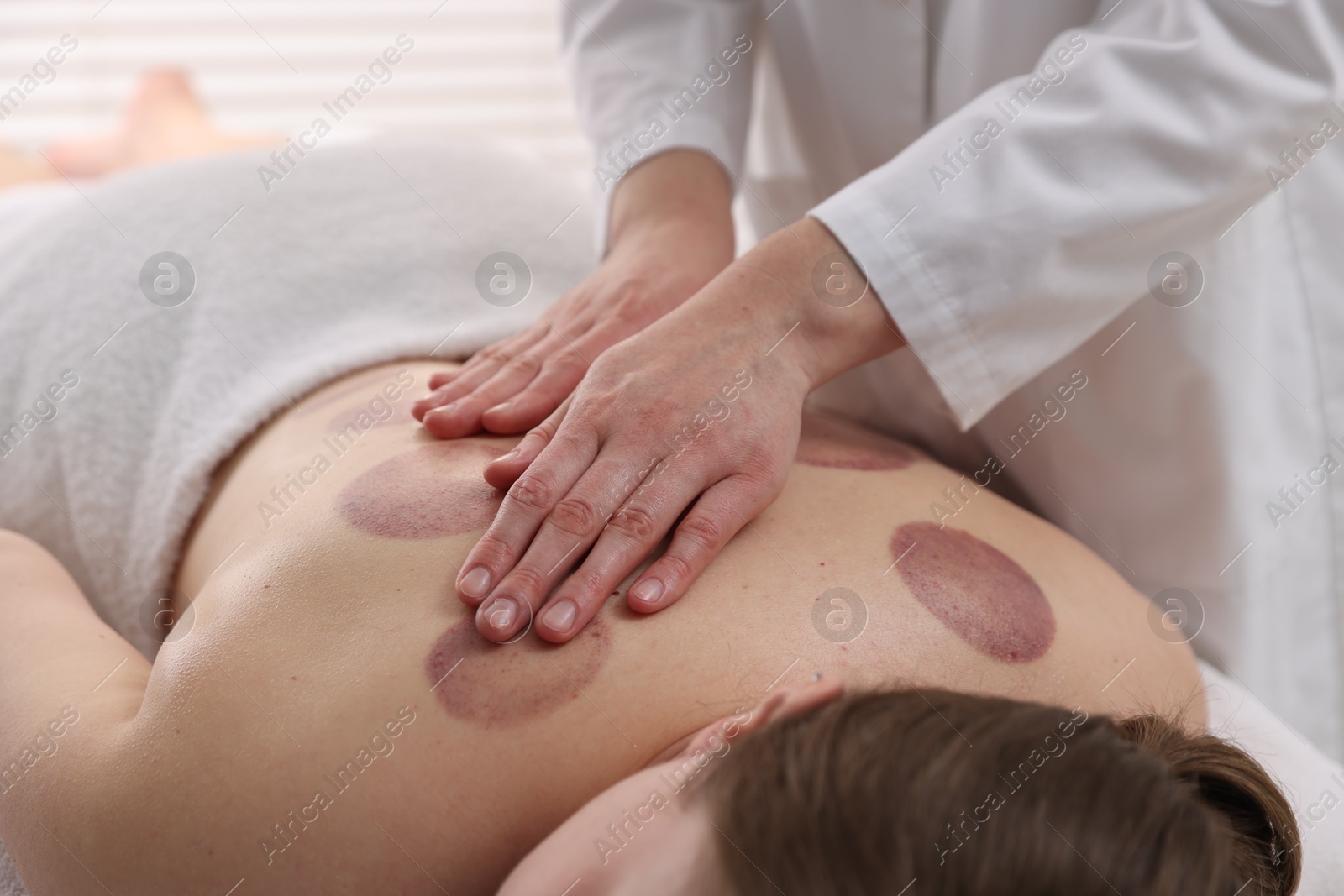 Cupping therapy. Woman receiving professional massage in spa salon, closeup Photo of Cupping therapy. Woman receiving professional massage in spa salon, closeup