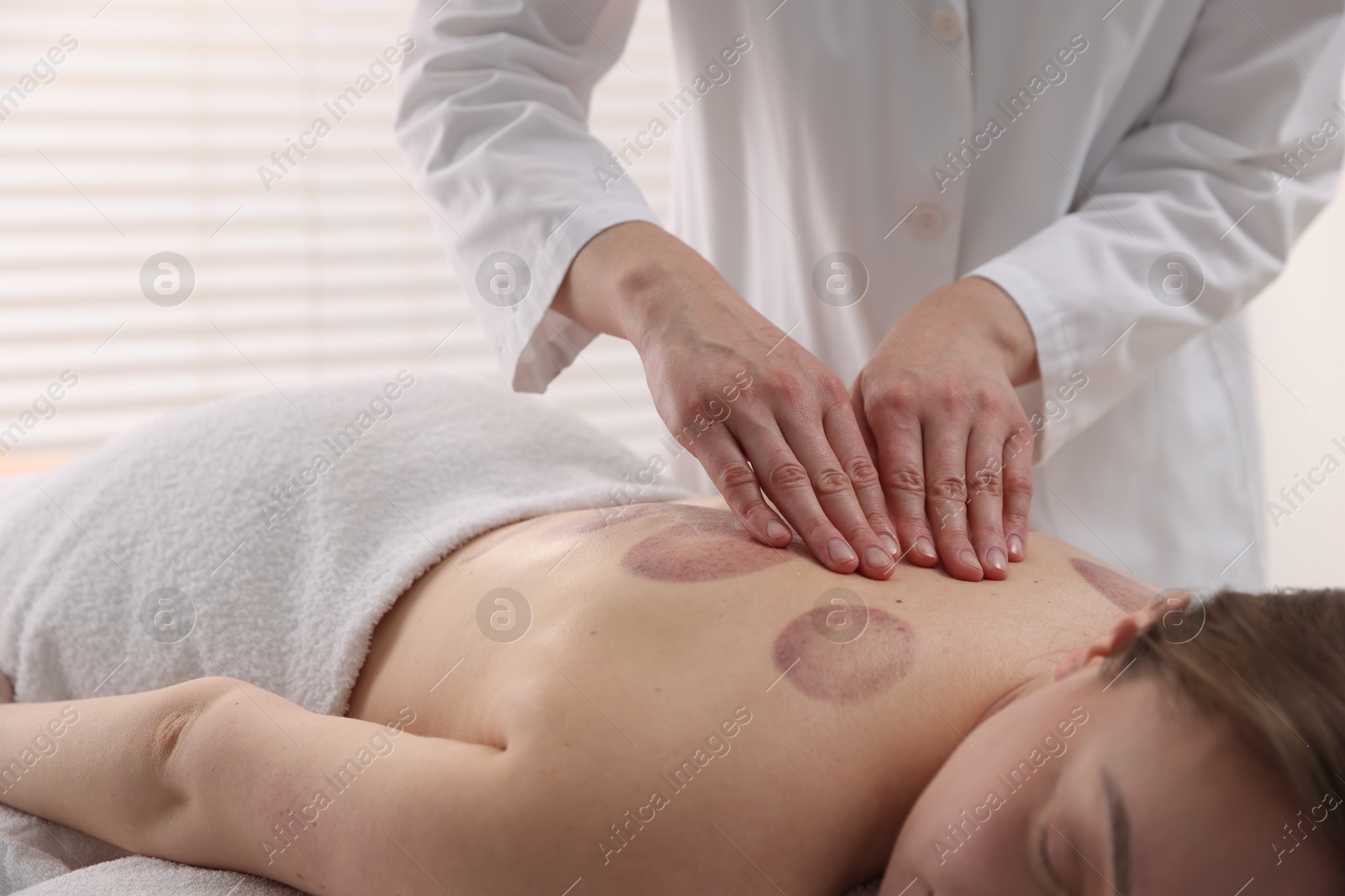 Cupping therapy. Woman receiving professional massage in spa salon, closeup Photo of Cupping therapy. Woman receiving professional massage in spa salon, closeup