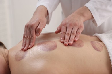 Photo of Cupping therapy. Woman receiving professional massage in spa salon, closeup