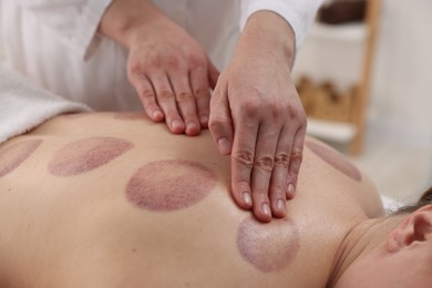 Photo of Cupping therapy. Woman receiving professional massage in spa salon, closeup