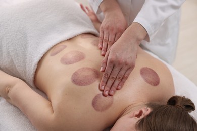 Photo of Cupping therapy. Woman receiving professional massage in spa salon, closeup