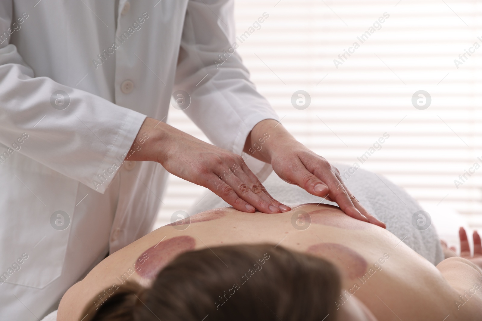 Cupping therapy. Woman receiving professional massage in spa salon, closeup Photo of Cupping therapy. Woman receiving professional massage in spa salon, closeup