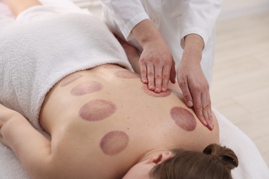 Photo of Cupping therapy. Woman receiving professional massage in spa salon, closeup