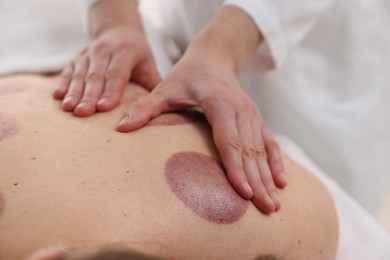 Photo of Cupping therapy. Woman receiving professional massage in spa salon, closeup