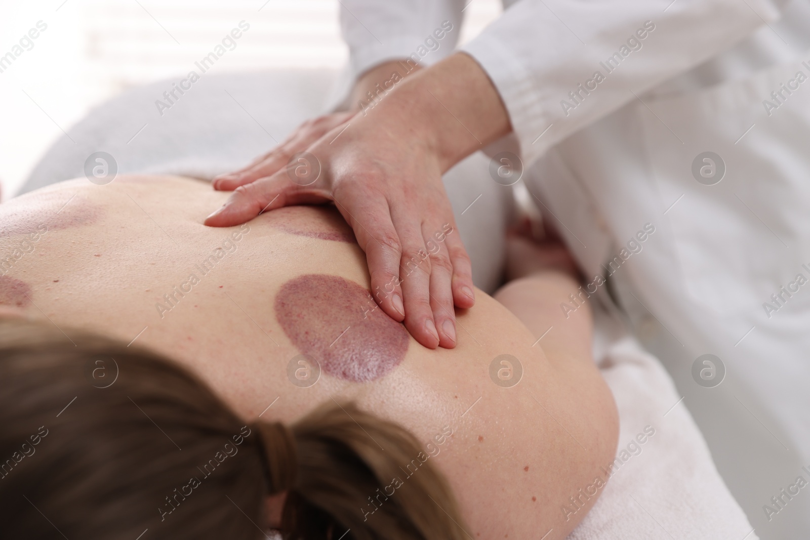Cupping therapy. Woman receiving professional massage in spa salon, closeup Photo of Cupping therapy. Woman receiving professional massage in spa salon, closeup