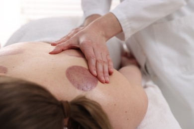 Photo of Cupping therapy. Woman receiving professional massage in spa salon, closeup