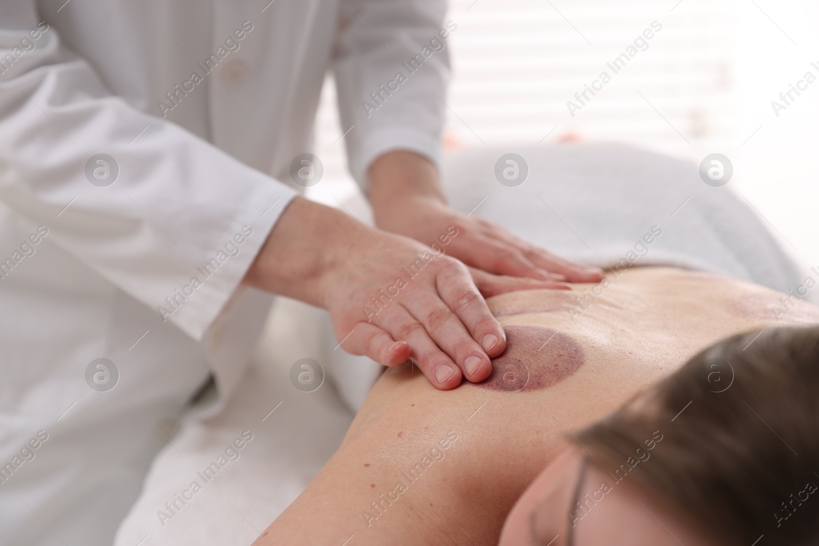 Cupping therapy. Woman receiving professional massage in spa salon, closeup Photo of Cupping therapy. Woman receiving professional massage in spa salon, closeup
