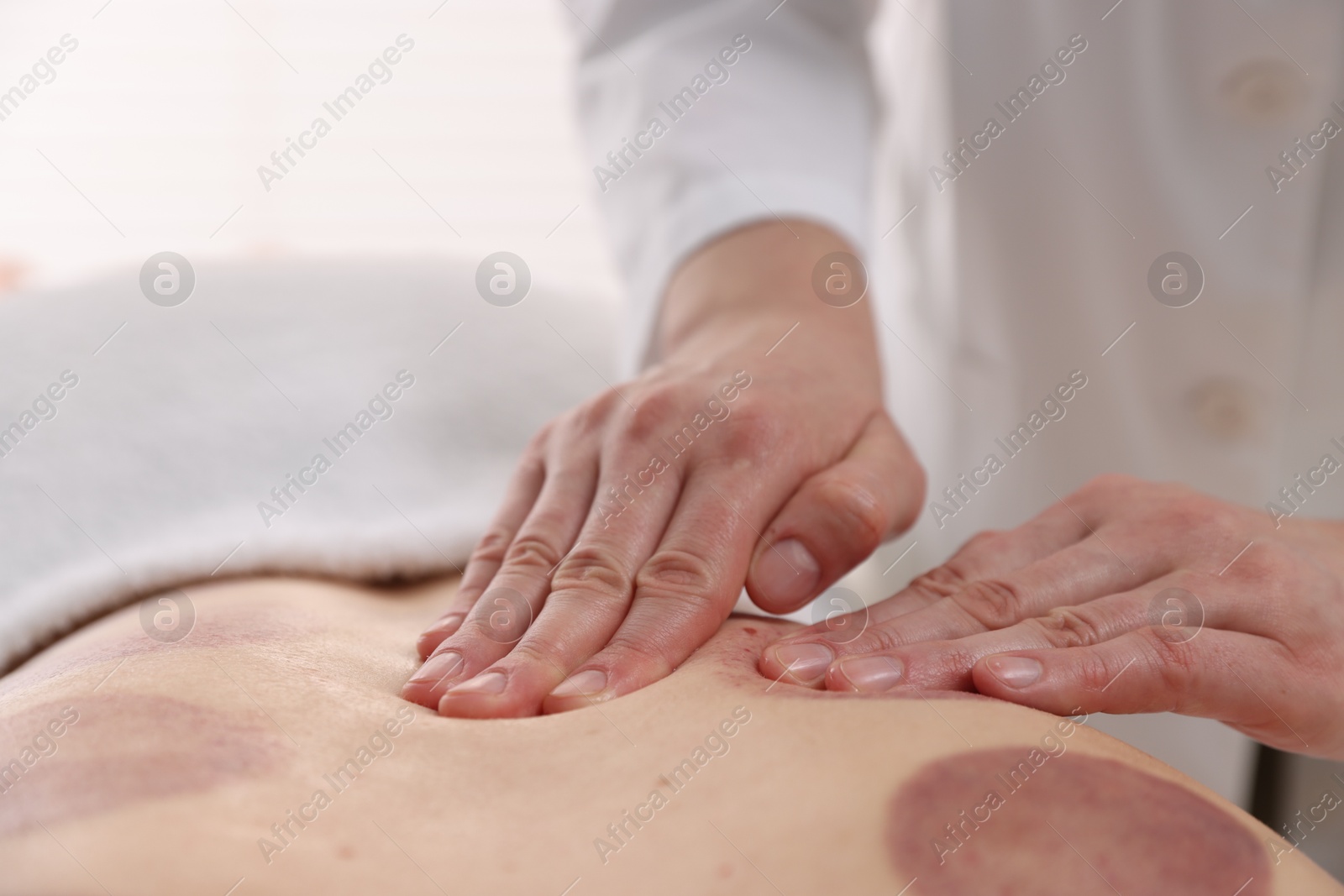 Cupping therapy. Woman receiving professional massage in spa salon, closeup Photo of Cupping therapy. Woman receiving professional massage in spa salon, closeup