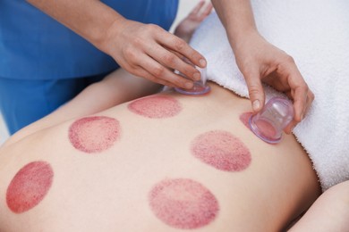 Photo of Therapist giving cupping treatment to patient in spa salon, closeup
