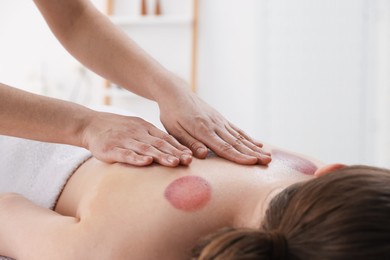 Photo of Cupping therapy. Woman receiving professional massage in spa salon, closeup