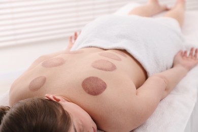 Photo of Woman after cupping therapy in spa salon, closeup