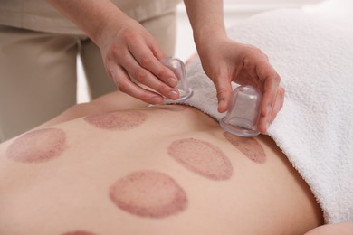 Photo of Therapist giving cupping treatment to patient in spa salon, closeup