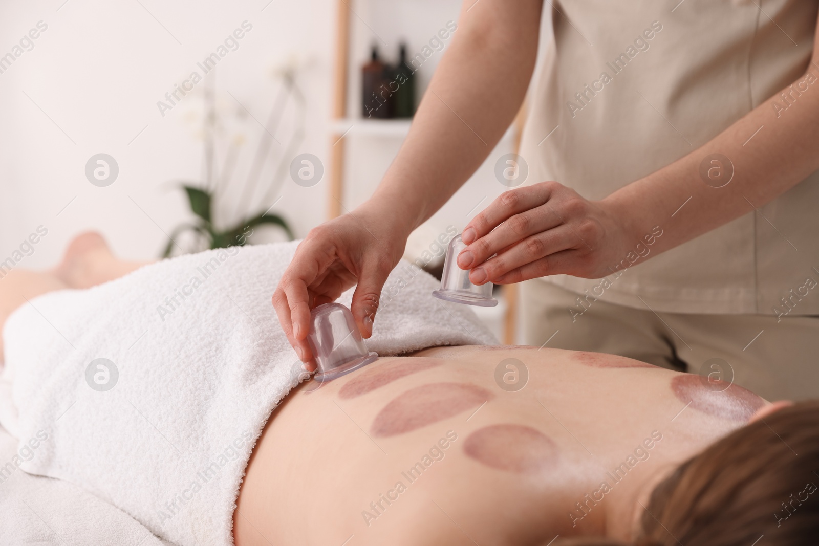 Therapist giving cupping treatment to patient in spa salon, closeup Photo of Therapist giving cupping treatment to patient in spa salon, closeup