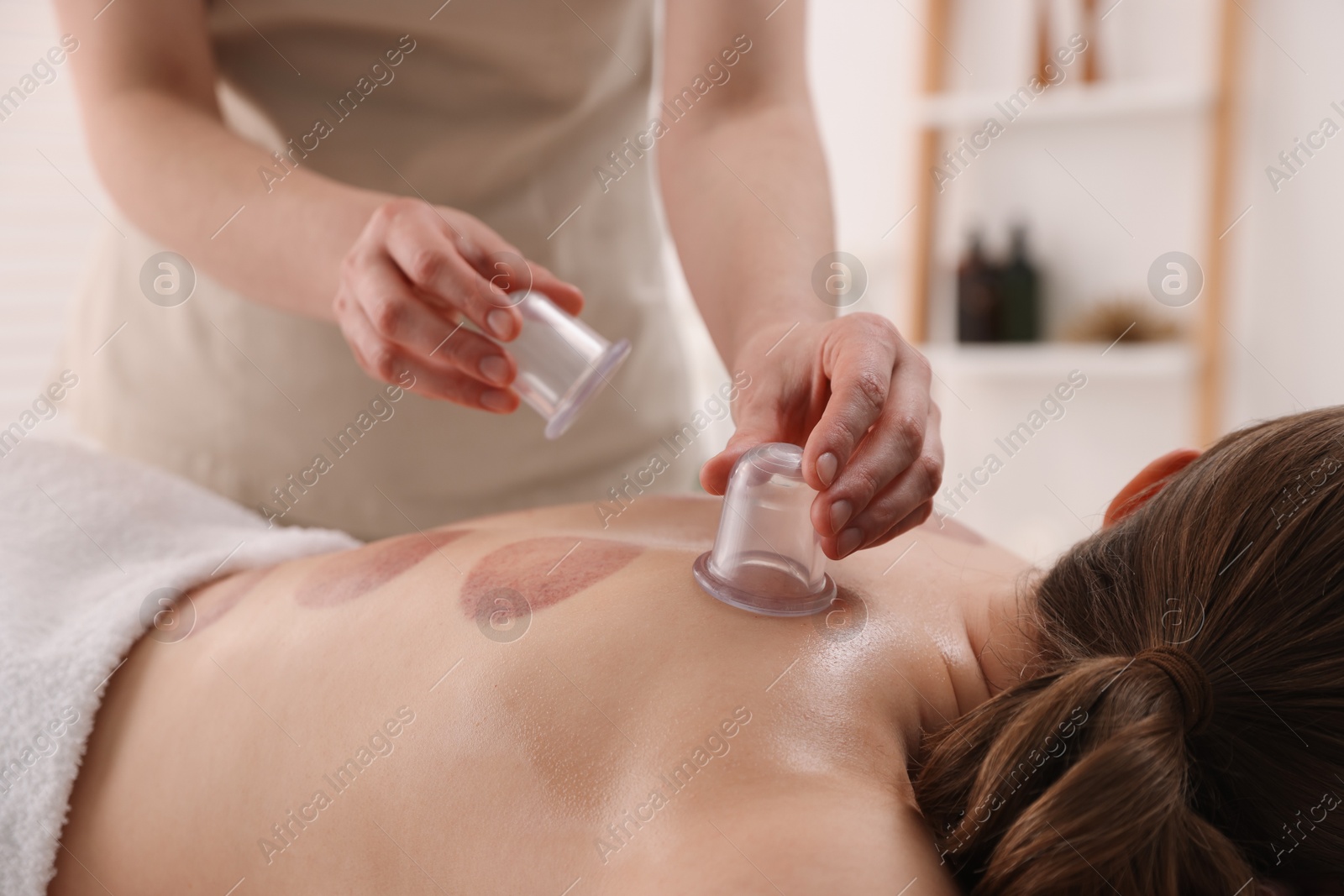Photo of Therapist giving cupping treatment to patient in spa salon, closeup