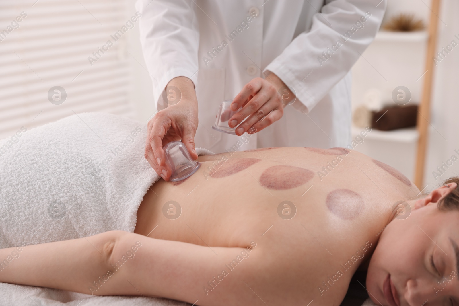 Photo of Therapist giving cupping treatment to patient in spa salon, closeup