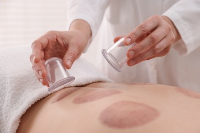 Photo of Therapist giving cupping treatment to patient in spa salon, closeup