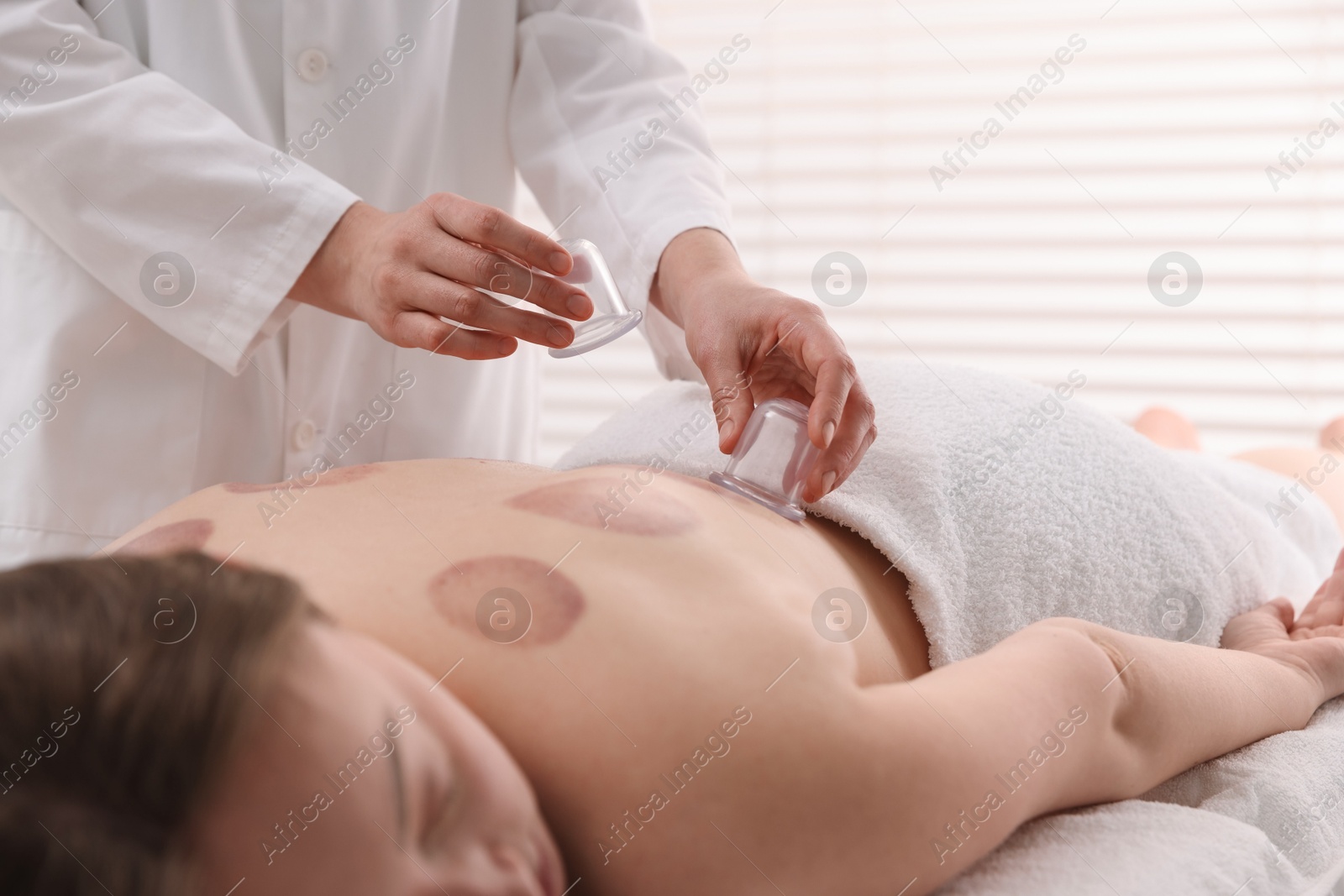 Photo of Therapist giving cupping treatment to patient in spa salon, closeup