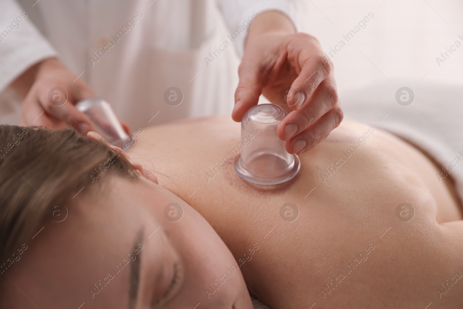 Therapist giving cupping treatment to patient in spa salon, closeup Photo of Therapist giving cupping treatment to patient in spa salon, closeup