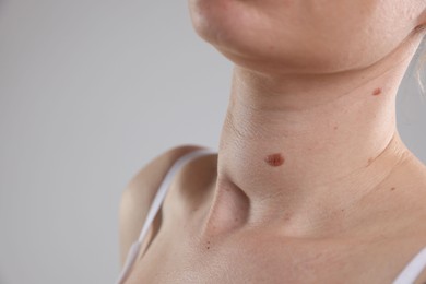 Photo of Woman with moles on her body against light background, closeup. Space for text