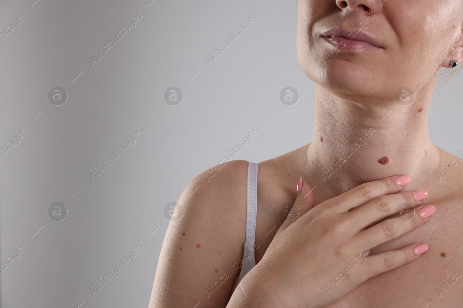 Woman with moles on her body against light background, closeup. Space for text Photo of Woman with moles on her body against light background, closeup. Space for text