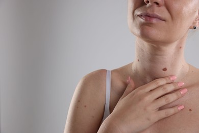 Photo of Woman with moles on her body against light background, closeup. Space for text
