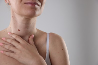 Photo of Woman with moles on her body against light background, closeup. Space for text