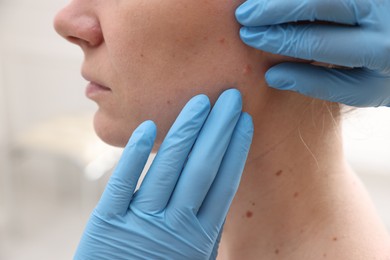 Photo of Doctor examining woman's moles in hospital, closeup