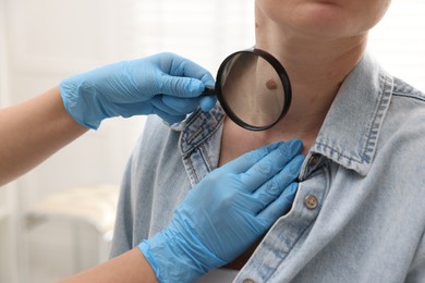 Photo of Doctor examining woman's moles in hospital, closeup