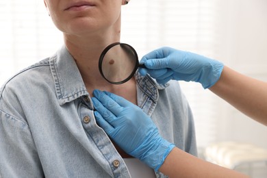 Photo of Doctor examining woman's moles in hospital, closeup