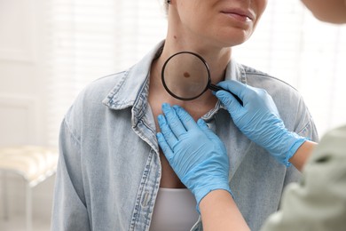 Photo of Doctor examining woman's moles in hospital, closeup