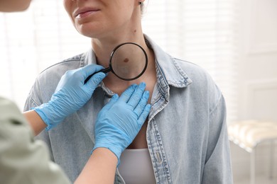 Photo of Doctor examining woman's moles in hospital, closeup