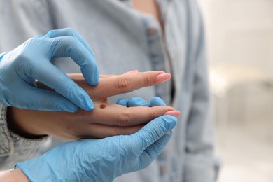 Photo of Doctor examining woman's moles in hospital, closeup