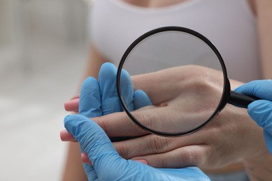 Photo of Doctor examining woman's moles in hospital, closeup
