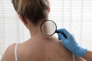 Photo of Doctor examining woman's moles in hospital, closeup