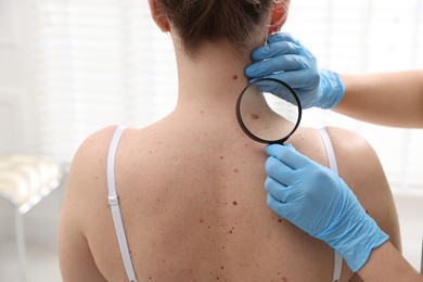 Photo of Doctor examining woman's moles in hospital, closeup