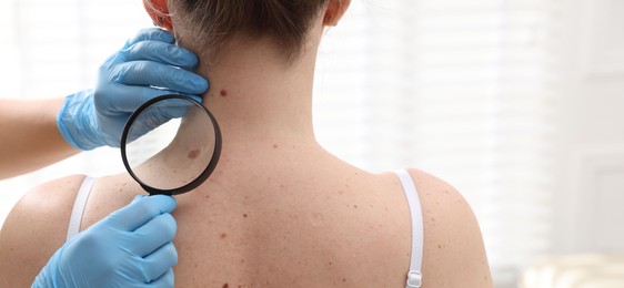 Photo of Doctor examining woman's moles in hospital, closeup. Space for text