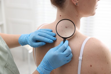 Photo of Doctor examining woman's moles in hospital, closeup