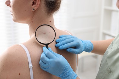 Photo of Doctor examining woman's moles in hospital, closeup