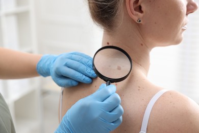 Photo of Doctor examining woman's moles in hospital, closeup